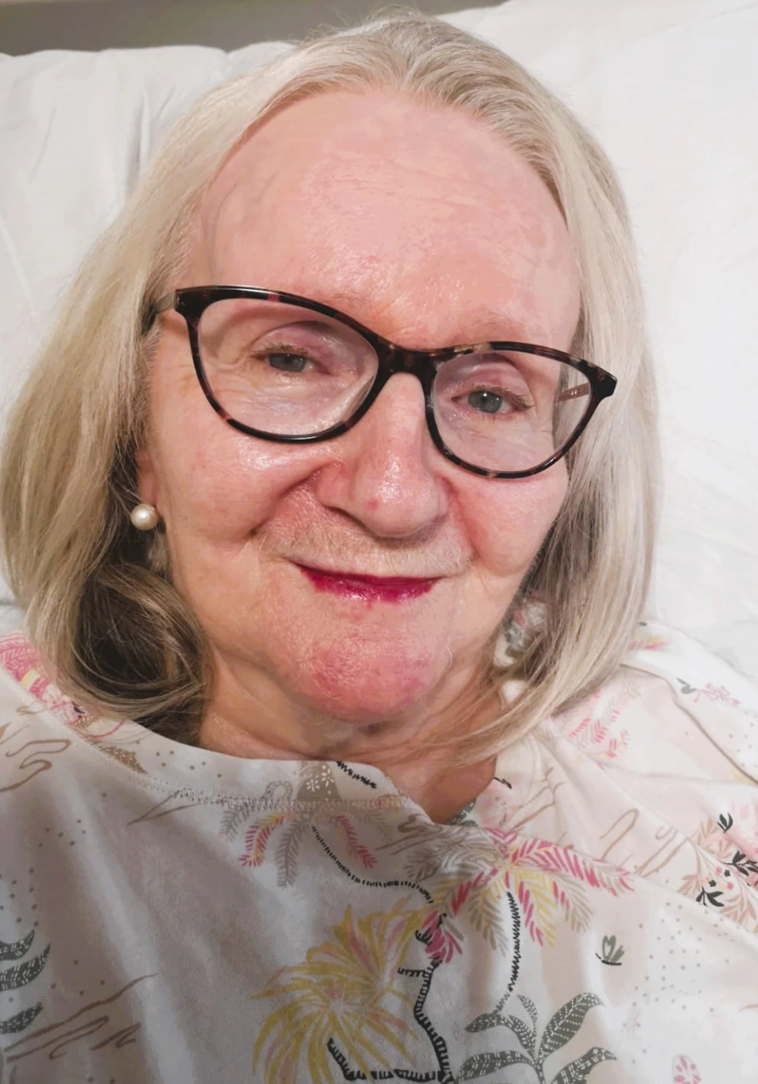 Isabel maintaining autonomy at home with specialist MS care by SD Care